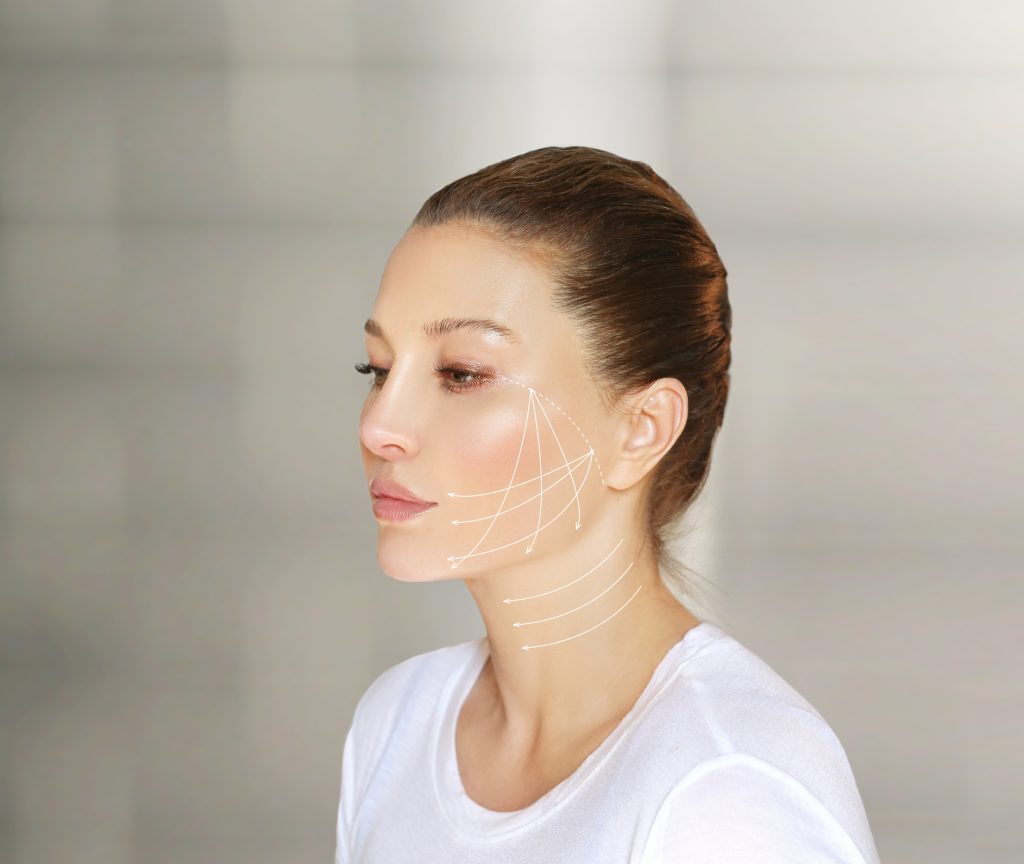 PDO Thread Lift - Glacier | Med Spa