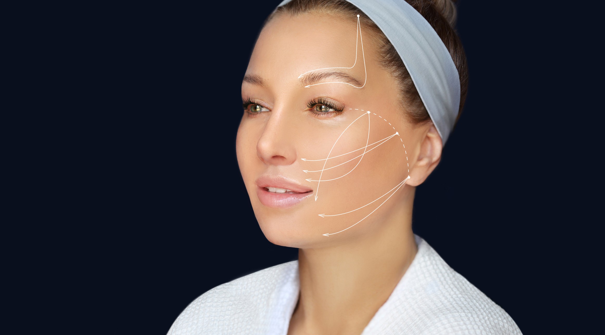 thread lift procedure ,non-surgical facelift,markup