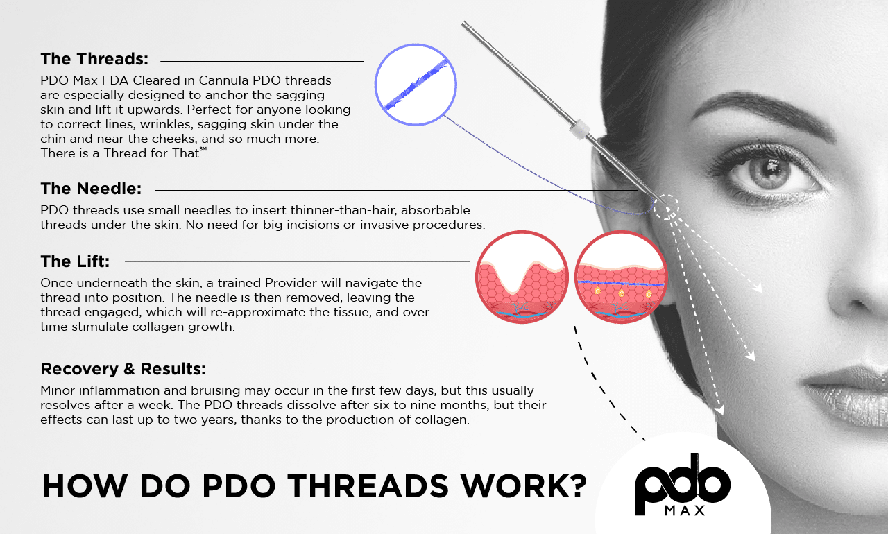PDO-Max_How-Do-Threads-Work_-002